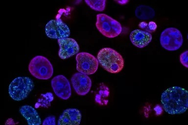 diagnostic-lab-case-gallery-6